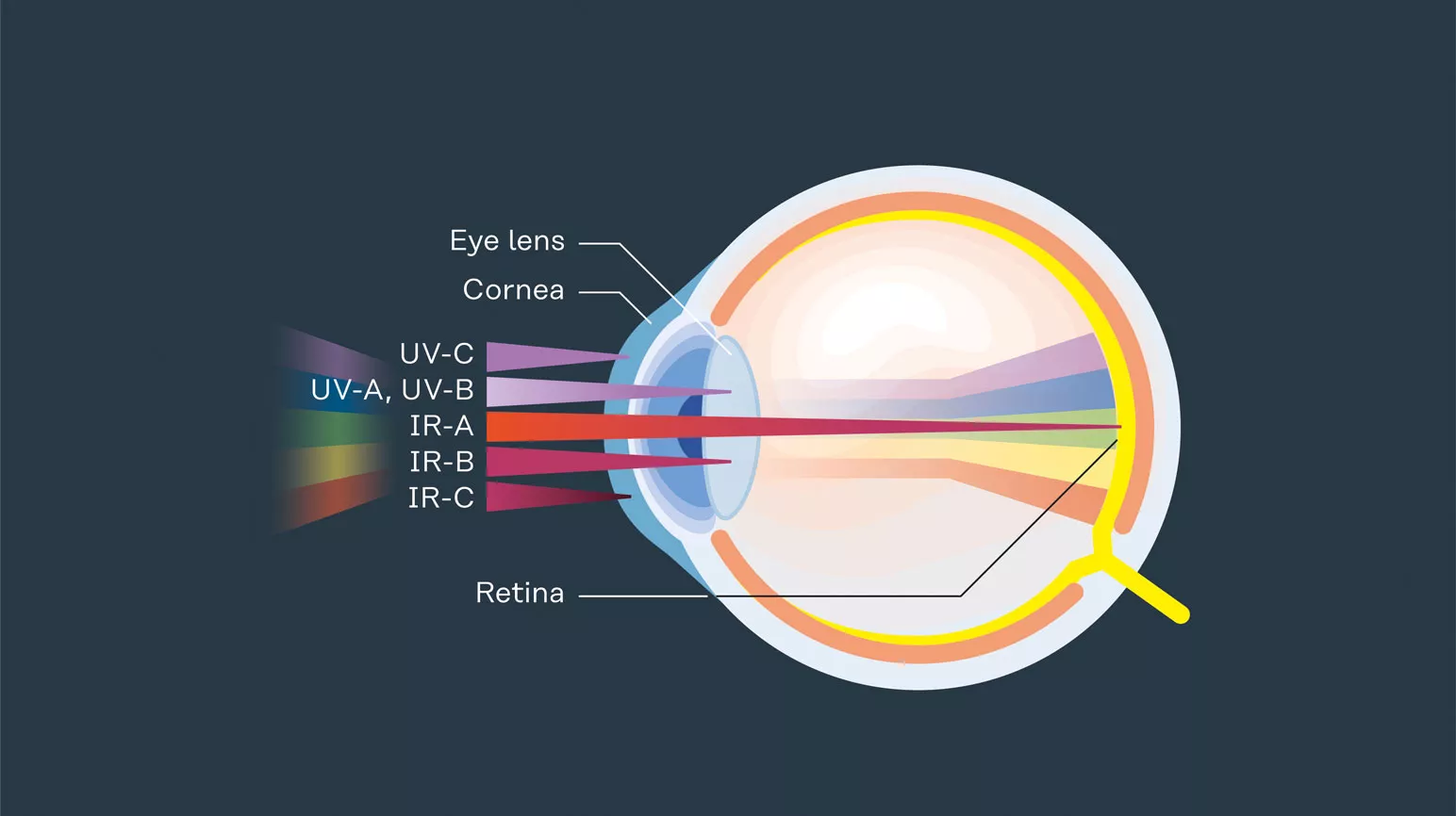 Arc eye EN